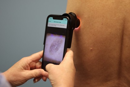 DERM Technology 2